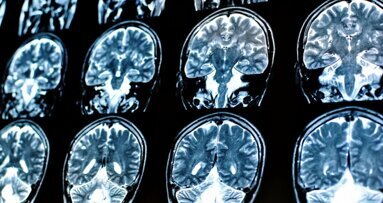 Nieuwe studie suggereert verband tussen hersenfunctie en mondgezondheid