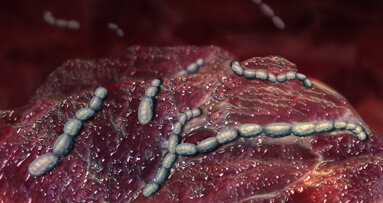 Dual-light photodynamic therapy helps kill oral bacteria