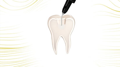 COLTENE – BRILLIANT Bulk Fill Flow - Aesthetic and durable restorations saving time and money