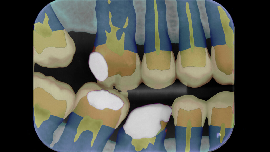 University spin-out raises funds for AI-driven dental diagnostics tool
