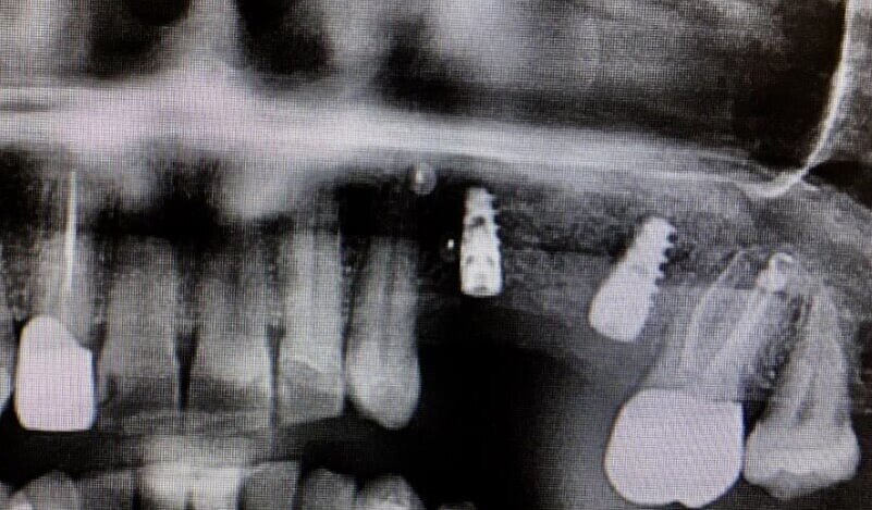 Fig. 18