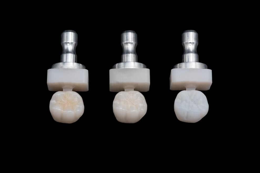 The edelweiss blocks mimic the natural tooth. (Image: edelweiss)