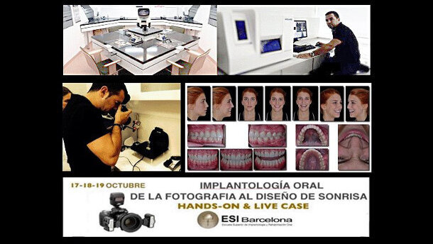 Curso de fotografía digital - diseño de la sonrisa