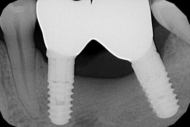 Fig. 19