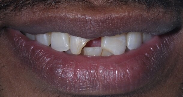 FIG01