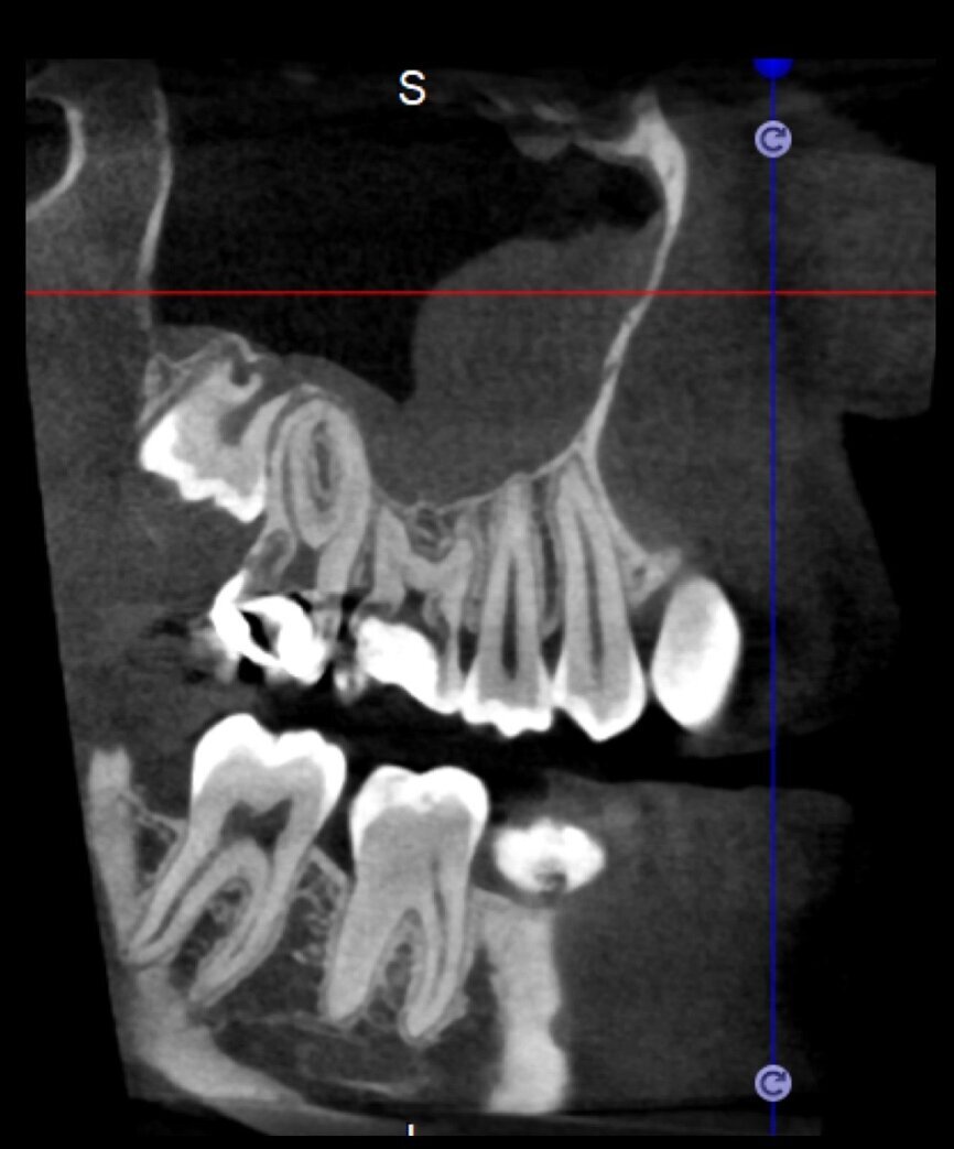 Fig. 11