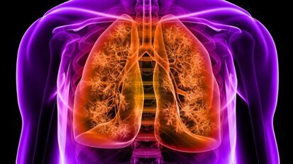 Des bactéries buccales liées au risque de pneumonie