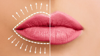 Nghiên cứu mới xem xét tác động của kích thước môi đến sự hấp dẫn của khuôn mặt
