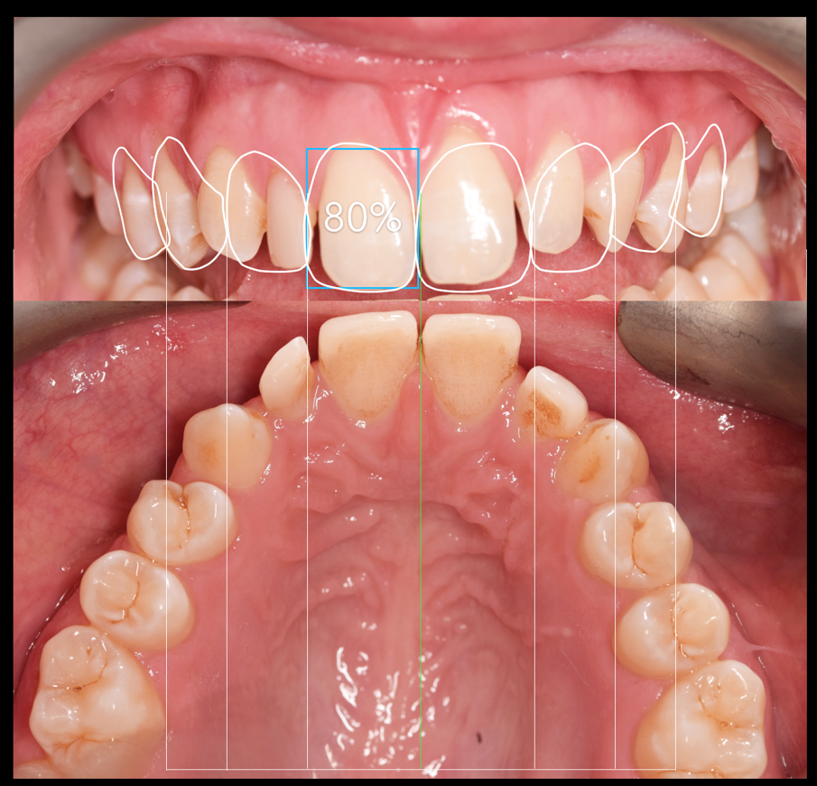 Fig. 1d