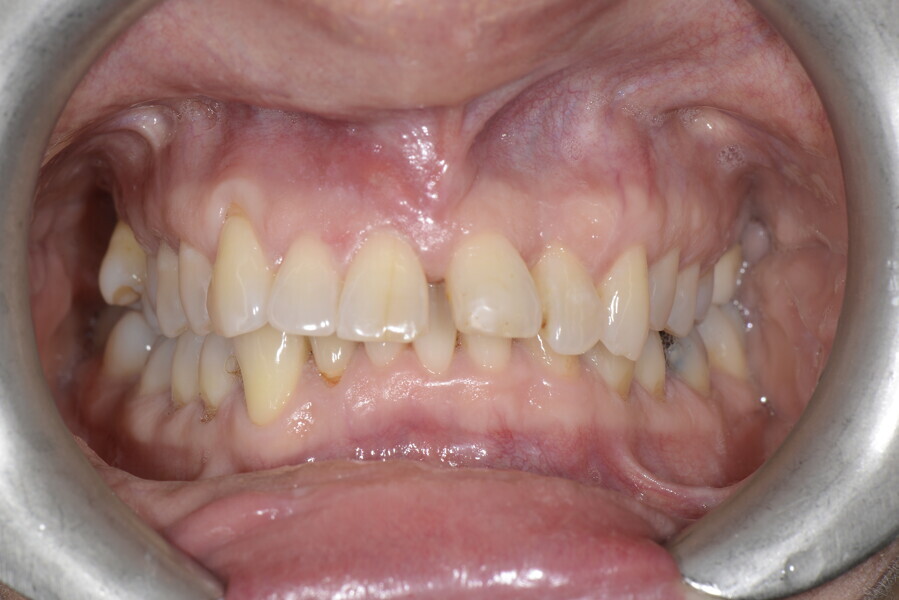 Fig. 4b