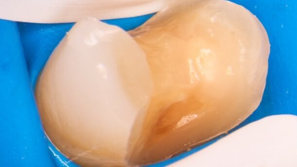 Stomatologia cyfrowa w codziennej praktyce