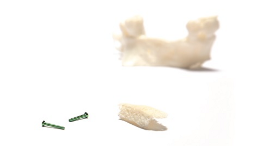 Straumann Allografts