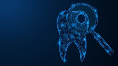 Phân tích mới điều tra độ chính xác của AI trong việc phát hiện sâu răng