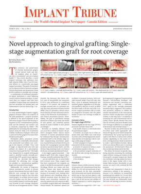 Implant Tribune Canada No. 1, 2016