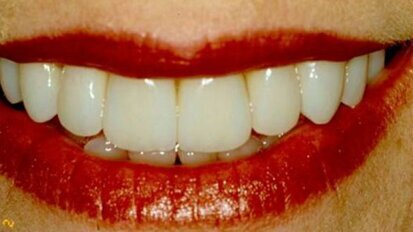 Se familiariser avec Insta-Ortho