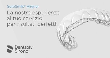 SureSmile Aligner: nuove soluzioni digitali per la moderna ortodonzia