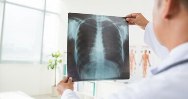 Tratamento da cárie pode prevenir pneumonia em pacientes com Parkinson