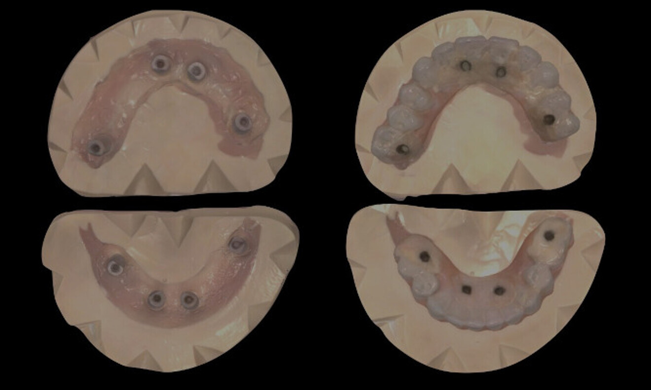 Fig. 11