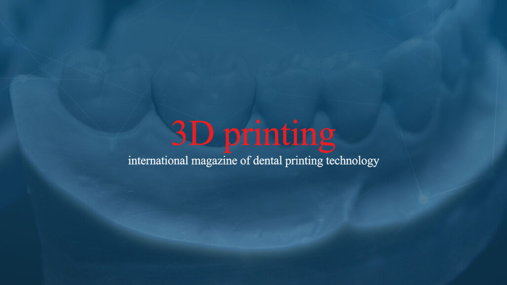 3D printing