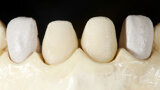 Fig. 8
