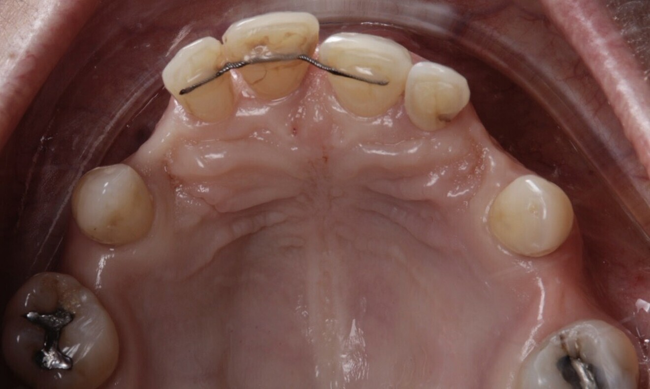 Fig. 6