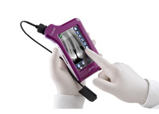 MyRay X-pod
