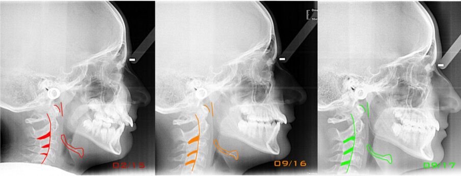 Fig. 14