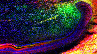 Scientists uncover gene that enhances tissue regeneration in tooth healing