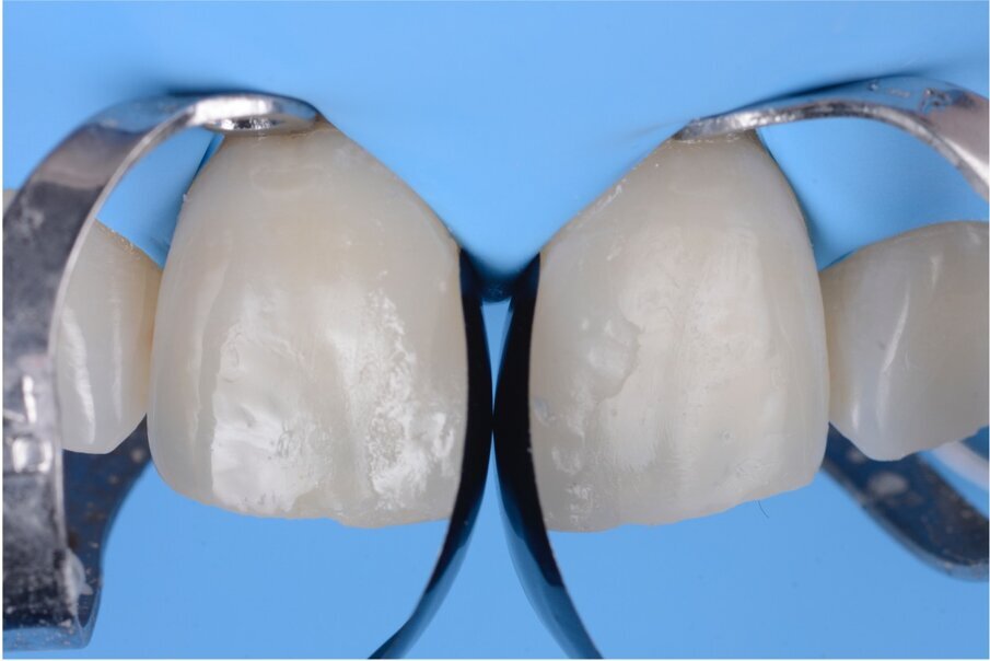 Case 3, Fig. 2.