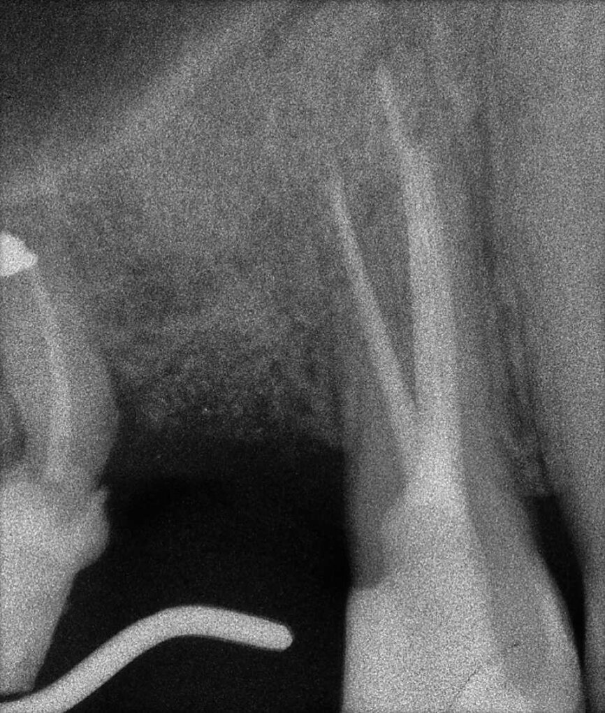 Figure 29