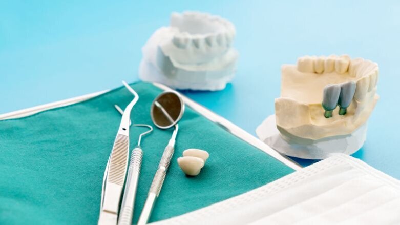 Mening publiek over implantaten