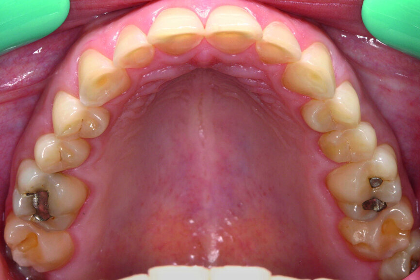 Fig.3