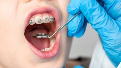 Scandinavische onderzoeken bieden nieuwe inzichten in mondgezondheid adolescenten