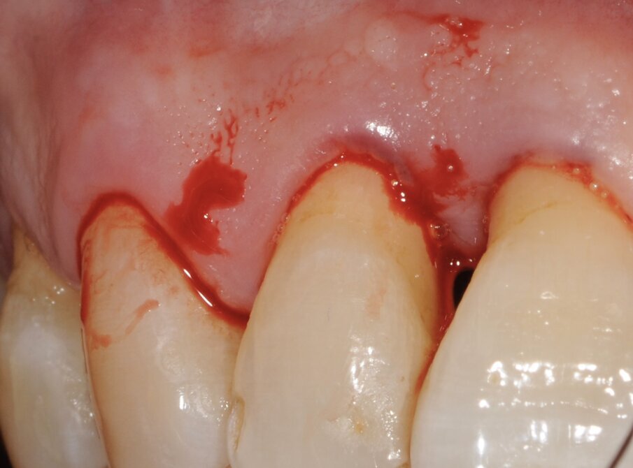 Fig. 6