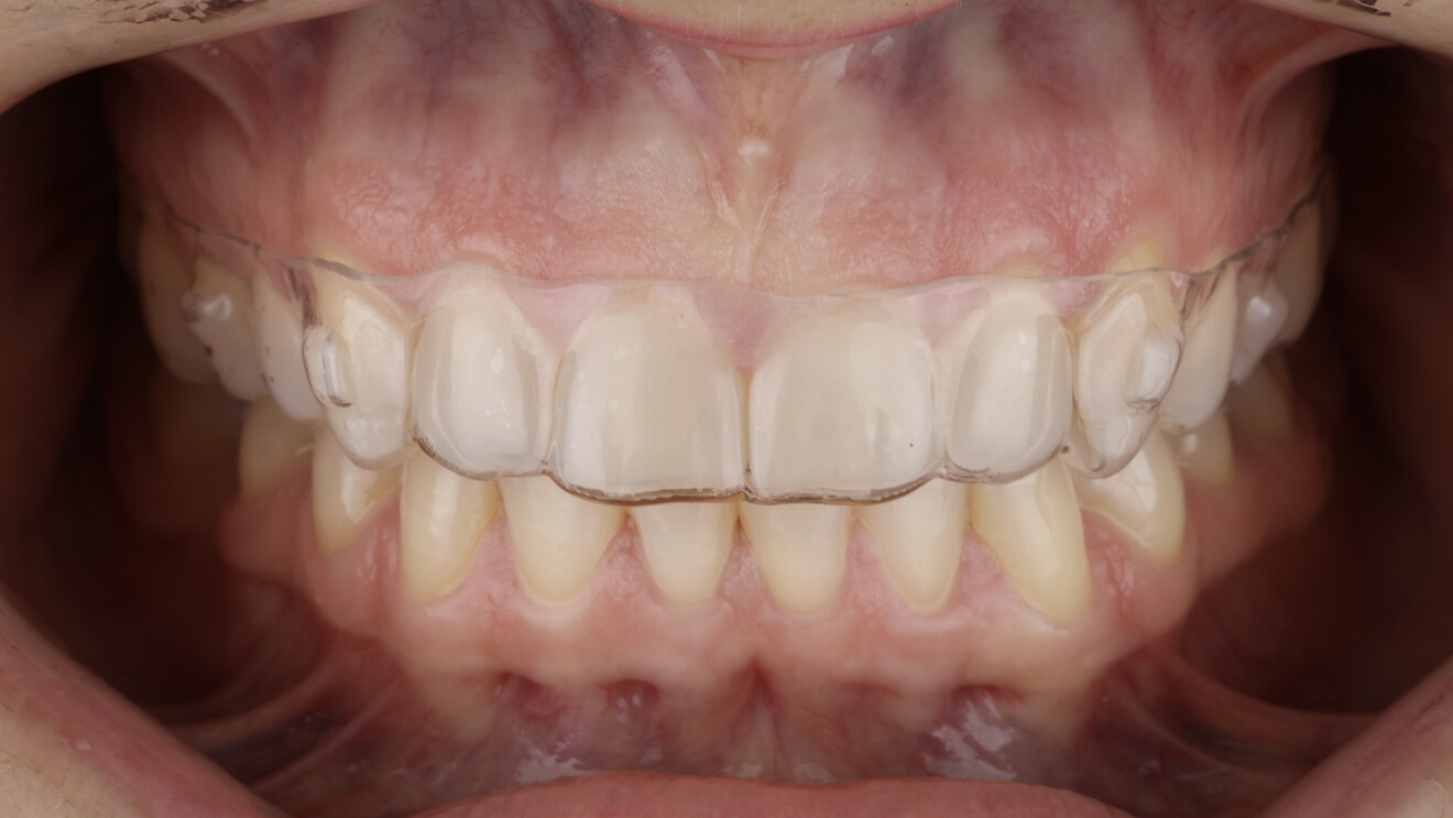 Fig. 16