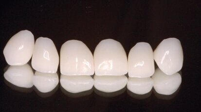 Co CAD/CAM zmienia w gabinecie