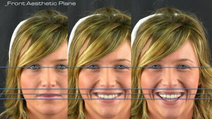 El diseñador digital de sonrisas