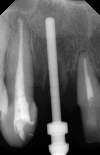 Fig. 13