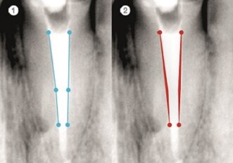 VDW Double Taper Form