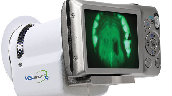 Study documents value of a device in fighting oral cancer