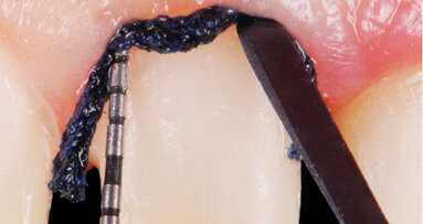 The new frontier restorative dentistry