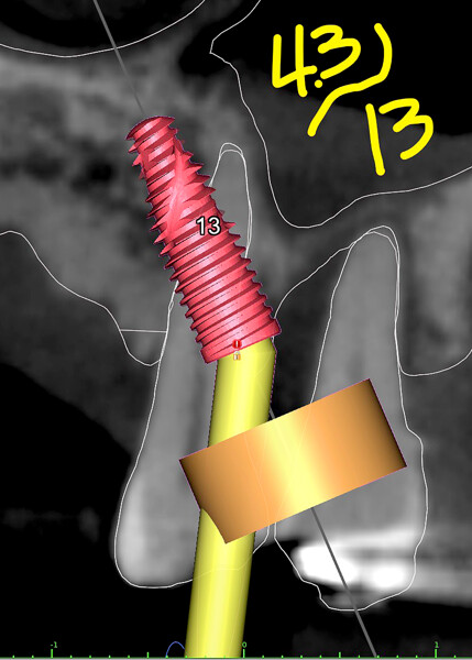 Fig. 5h