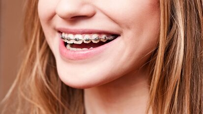 Orthodontist ‘beste baan van 2016’ in VS