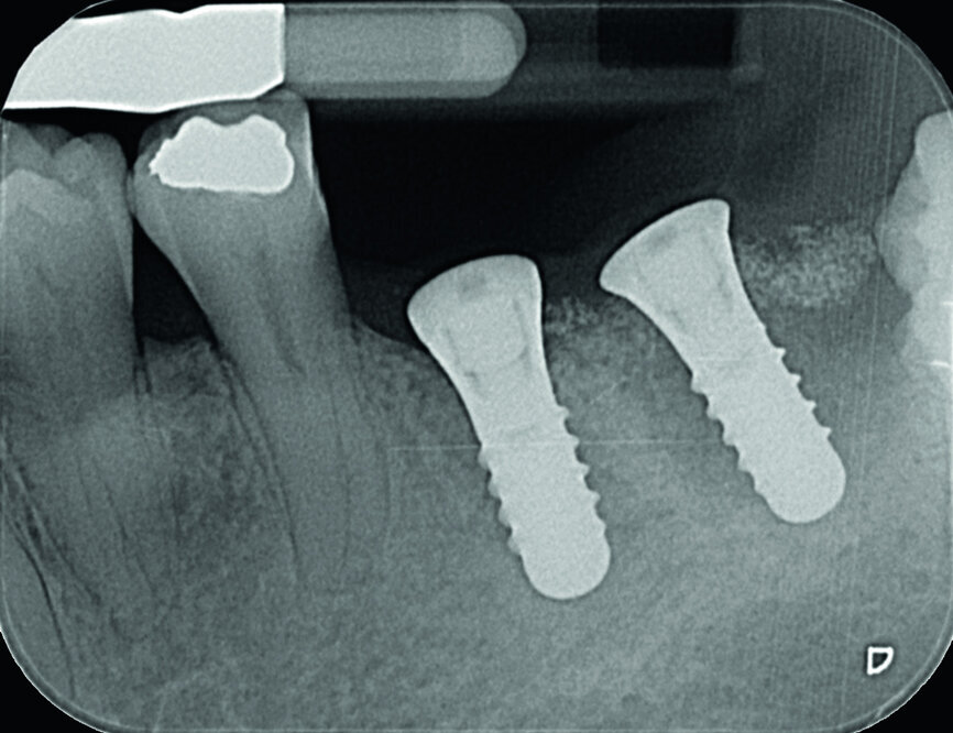Fig. 12
