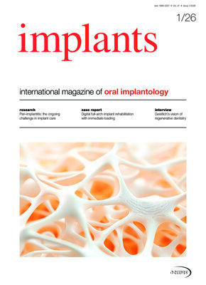 implants international No. 1, 2026
