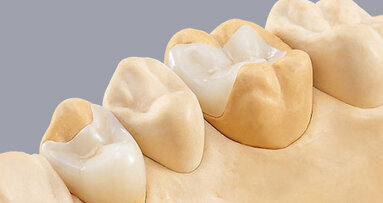 CAD/CAM, la tecnología que está revolucionando la industria dental (2)