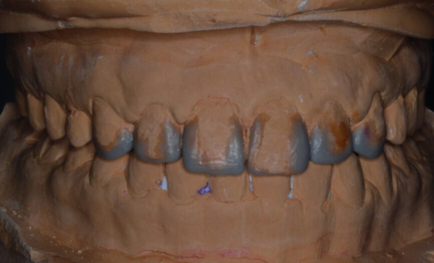 Fig. 37