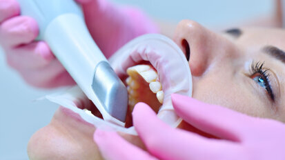 Study finds intra-oral scanner viable alternative to visual clinical evaluation in detecting caries