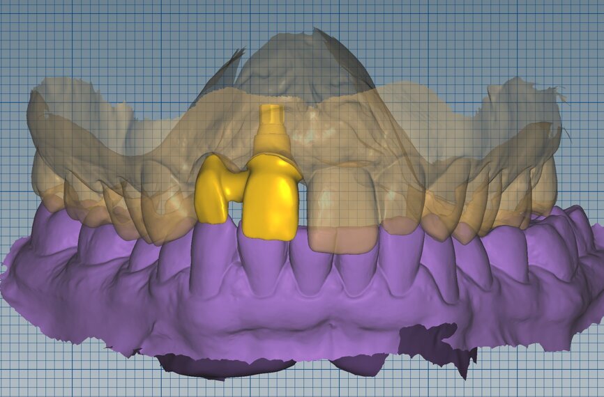 Fig 19