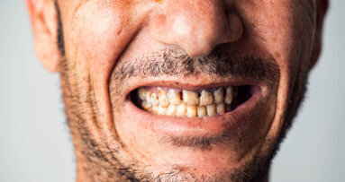 New Zealand’s oral health crisis rages on
